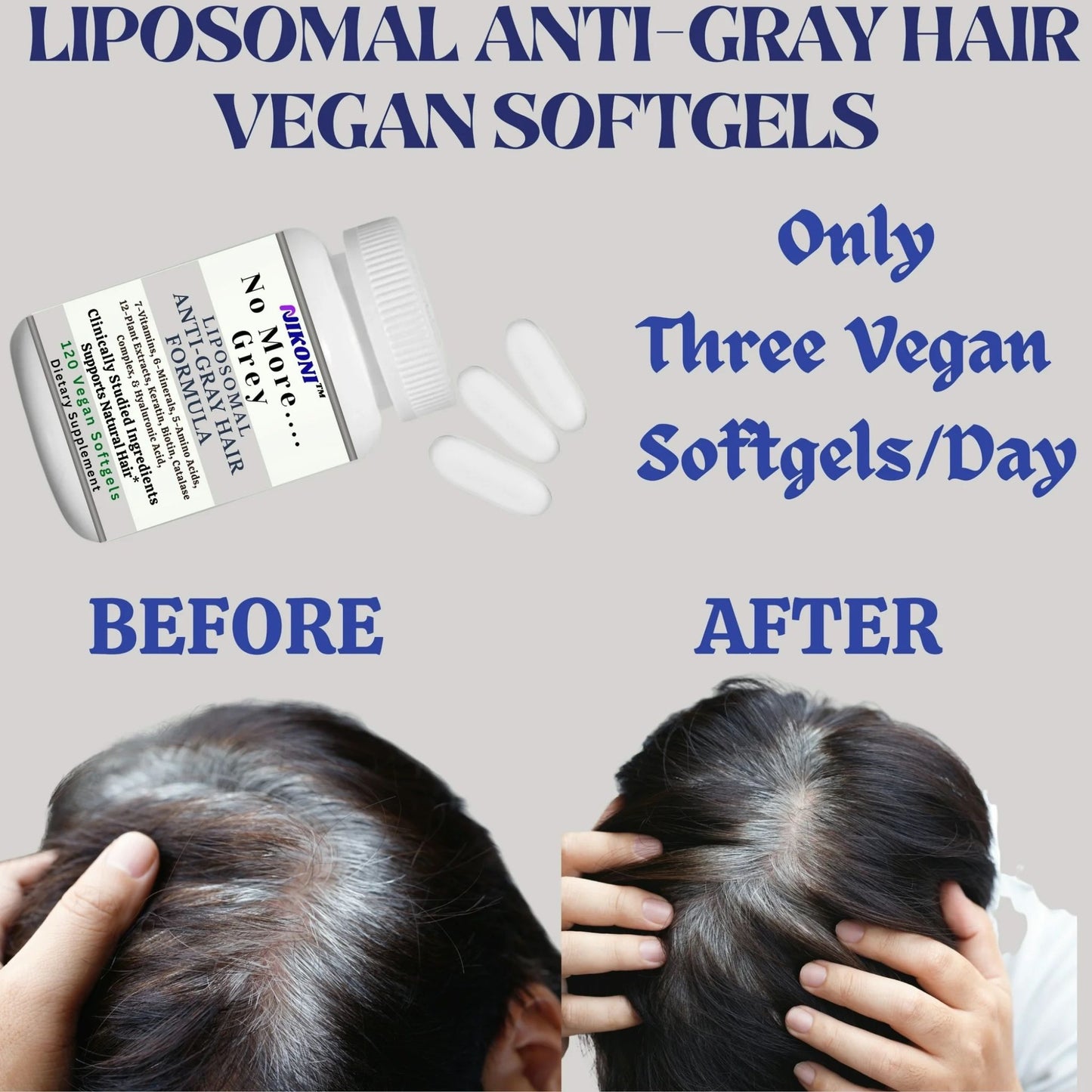 Nikoni Liposomal Anti Gray Hair Formula – 7 Vitamins, 6 Minerals, 5 Amino Acids & 12 Plant Extracts, for Healthy Hair Maintenance– 120 Vegan Softgels